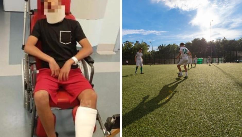 pg-米体：意大利一场青少年比赛，13岁门将被对方球员父亲打骨折